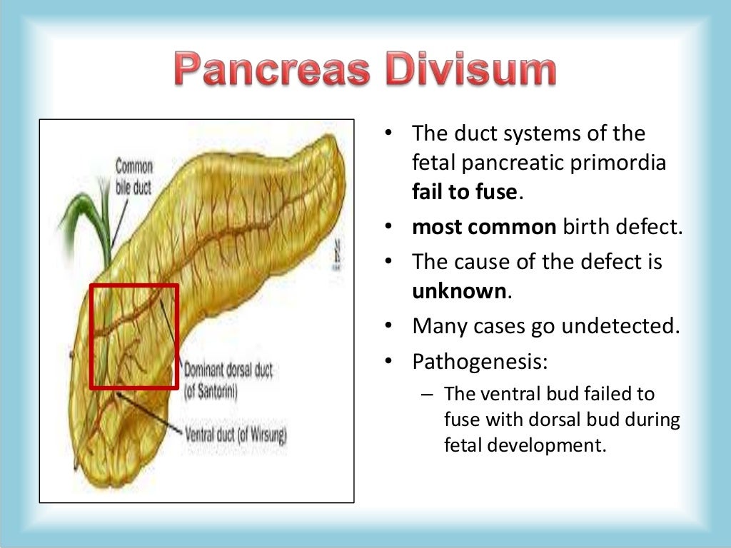 Pancreas Congenital Anomalies (agenesis, pancreas divisum, annular pa…