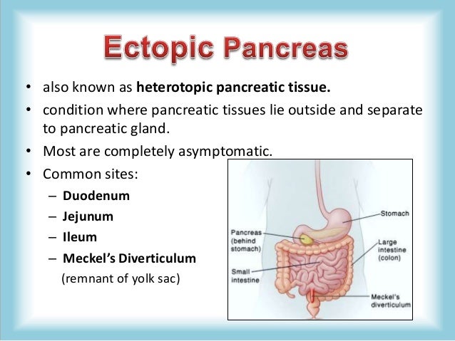 Pancreas Congenital Anomalies (agenesis, pancreas divisum, annular pa…