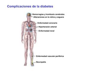 Complicaciones de la diabetes 
Hemorragias y trombosis cerebrales 
Alteraciones en la retina y ceguera 
Enfermedad coronaria 
Hipertensión arterial 
Enfermedad renal 
Enfermedad vascular periférica 
Neuropatía 
 