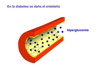 En la diabetes se daña el endotelio 
hiperglucemia 
 