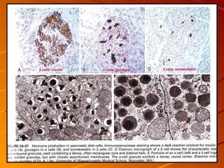 Patho B Pancreas Patho B 2 | PPT