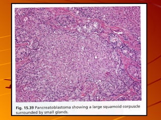 Patho B Pancreas Patho B 2 | PPT