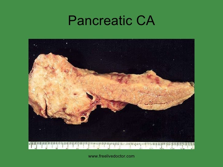Pancreas pathology