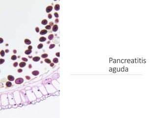 Pancreatitis
aguda
 