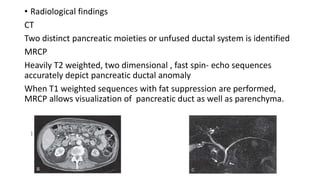 • Radiological findings
CT
Two distinct pancreatic moieties or unfused ductal system is identified
MRCP
Heavily T2 weighted, two dimensional , fast spin- echo sequences
accurately depict pancreatic ductal anomaly
When T1 weighted sequences with fat suppression are performed,
MRCP allows visualization of pancreatic duct as well as parenchyma.
 