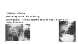 • Radiological findings
Plain radiographs-double bubble sign
Barium studies -extrinsic eccentric defect on medial margin of 2nd
part of duodenum
 