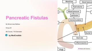Pancreatic Fistulas
By Nirmal Jose Mathew
Group 25
6th Course, 11th Semester
by MedCredible
 