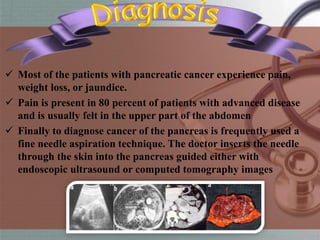Pancreatic Cancer | PPTX