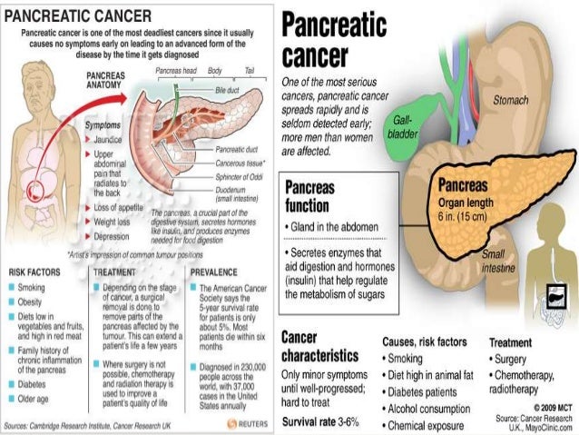 Como empezo mi cancer de pancreas