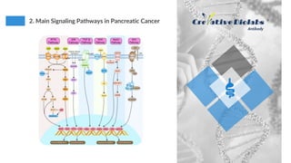 An Overview of Pancreatic Cancer - Creative Biolabs | PPTX