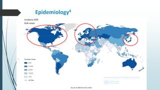 Epidemiology4
 