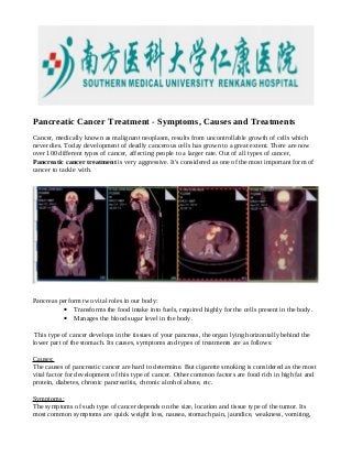 Pancreatic Cancer Treatment - Symptoms, Causes and Treatments
Cancer, medically known as malignant neoplasm, results from uncontrollable growth of cells which
never dies. Today development of deadly cancerous cells has grown to a great extent. There are now
over 100 different types of cancer, affecting people to a larger rate. Out of all types of cancer,
Pancreatic cancer treatment is very aggressive. It's considered as one of the most important form of
cancer to tackle with.

Pancreas perform two vital roles in our body:
• Transforms the food intake into fuels, required highly for the cells present in the body.
• Manages the blood sugar level in the body.
This type of cancer develops in the tissues of your pancreas, the organ lying horizontally behind the
lower part of the stomach. Its causes, symptoms and types of treatments are as follows:
Causes:
The causes of pancreatic cancer are hard to determine. But cigarette smoking is considered as the most
vital factor for development of this type of cancer. Other common factors are food rich in high fat and
protein, diabetes, chronic pancreatitis, chronic alcohol abuse, etc.
Symptoms:
The symptoms of such type of cancer depends on the size, location and tissue type of the tumor. Its
most common symptoms are quick weight loss, nausea, stomach pain, jaundice, weakness, vomiting,

 