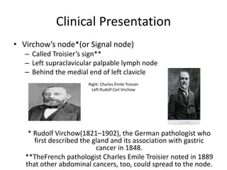 Toisier Sign Pancreatic Carcinoma | PPTX