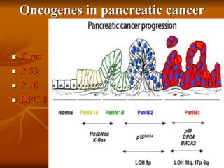 Oncogenes in pancreatic cancer
 K ras
 P 53
 P 16
 DPC 4
 
