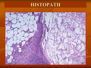 HISTOPATH
 
