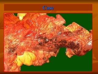 Case
 