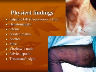Physical findings
 Palpable GB (Courvoisier’s law)
 Hepatomegaly
 Icterus
 Scratch marks
 Ascites
 Mass
 Virchow’s node
 Pelvic deposit
 Trousseau’s sign
 