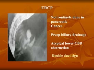 ERCP
Double duct sign
Not routinely done in
pancreatic
Cancer
Preop biliary drainage
Atypical lower CBD
obstruction
 