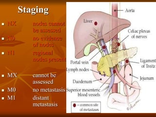 Staging
 NX nodes cannot
be assessed
 N0 no evidence
of nodes
 N1 regional
nodes present
 MX cannot be
assessed
 M0 no metastasis
 M1 distant
metastasis
 