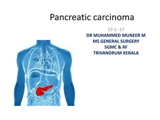 Pancreatic carcinoma
27-1 -17
DR MUHAMMED MUNEER M
MS GENERAL SURGERY
SGMC & RF
TRIVANDRUM KERALA
 
