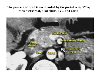 Pancreatic carcinoma dr mnr