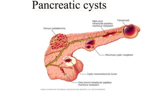 Pancreatic cysts
 
