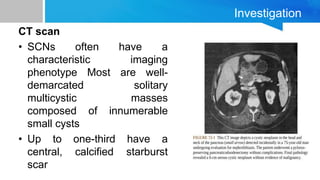 Investigation
CT scan
• SCNs often have a
characteristic imaging
phenotype Most are well-
demarcated solitary
multicystic masses
composed of innumerable
small cysts
• Up to one-third have a
central, calcified starburst
scar
 