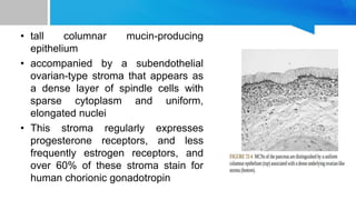 • tall columnar mucin-producing
epithelium
• accompanied by a subendothelial
ovarian-type stroma that appears as
a dense layer of spindle cells with
sparse cytoplasm and uniform,
elongated nuclei
• This stroma regularly expresses
progesterone receptors, and less
frequently estrogen receptors, and
over 60% of these stroma stain for
human chorionic gonadotropin
 
