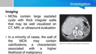 Investigation
Imaging
• MCNs contain large septated
cysts with thick irregular walls
that may be well visualized on
CT, MRI, or ultrasound evaluation
• In a minority of cases, the wall of
the MCN may contain
calcifications, a characteristic
associated with a higher
likelihood of malignancy
 