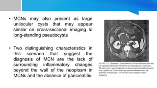 • MCNs may also present as large
unilocular cysts that may appear
similar on cross-sectional imaging to
long-standing pseudocysts
• Two distinguishing characteristics in
this scenario that suggest the
diagnosis of MCN are the lack of
surrounding inflammatory changes
beyond the wall of the neoplasm in
MCNs and the absence of pancreatitis
 