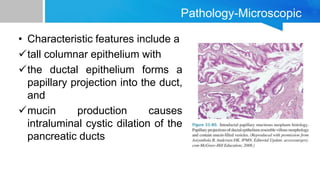 Pathology-Microscopic
• Characteristic features include a
tall columnar epithelium with
the ductal epithelium forms a
papillary projection into the duct,
and
mucin production causes
intraluminal cystic dilation of the
pancreatic ducts
 