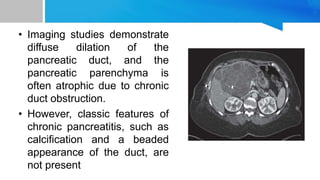• Imaging studies demonstrate
diffuse dilation of the
pancreatic duct, and the
pancreatic parenchyma is
often atrophic due to chronic
duct obstruction.
• However, classic features of
chronic pancreatitis, such as
calcification and a beaded
appearance of the duct, are
not present
 