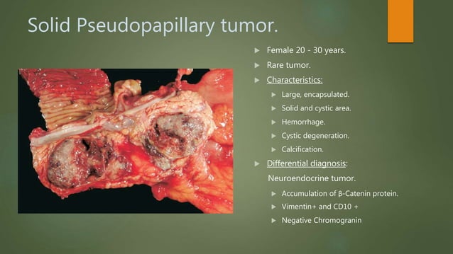 Pancreatic cystic neoplasm: Definition, Classification, Diagnosis and ...