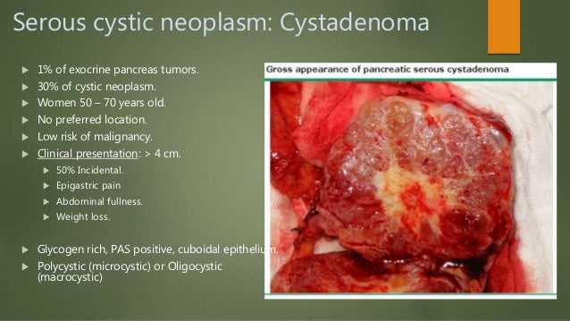 Definition Of Natural History Of Disease Definition Of Natural History Of Disease