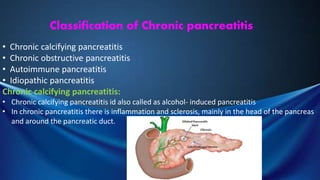 Classification of Chronic pancreatitis
• Chronic calcifying pancreatitis
• Chronic obstructive pancreatitis
• Autoimmune pancreatitis
• Idiopathic pancreatitis
Chronic calcifying pancreatitis:
• Chronic calcifying pancreatitis id also called as alcohol- induced pancreatitis
• In chronic pancreatitis there is inflammation and sclerosis, mainly in the head of the pancreas
and around the pancreatic duct.
 