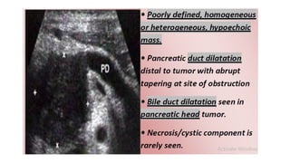 Comprehensive Imaging and Diagnosis of Solid Pancreatic Lesions | PPTX