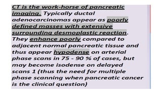 Comprehensive Imaging and Diagnosis of Solid Pancreatic Lesions | PPTX