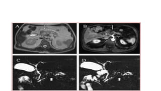 Comprehensive Imaging and Diagnosis of Solid Pancreatic Lesions | PPTX