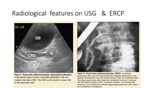 Comprehensive Imaging and Diagnosis of Solid Pancreatic Lesions | PPTX