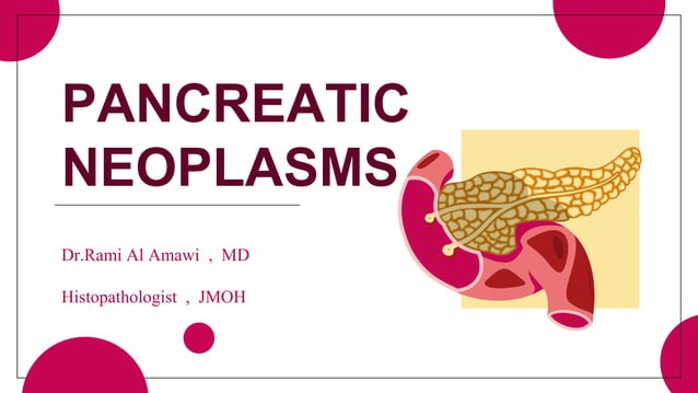 PANCREATIC NEOPLASM HISTOPATHOLOGY .pptx | Endocrine and Metabolic ...