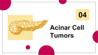 Acinar Cell
Tumors
04
 