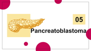 Pancreatoblastoma
05
 