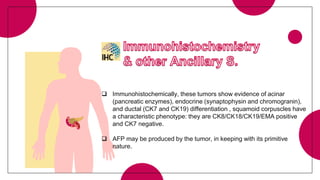  Immunohistochemically, these tumors show evidence of acinar
(pancreatic enzymes), endocrine (synaptophysin and chromogranin),
and ductal (CK7 and CK19) differentiation , squamoid corpuscles have
a characteristic phenotype: they are CK8/CK18/CK19/EMA positive
and CK7 negative.
 AFP may be produced by the tumor, in keeping with its primitive
nature.
 