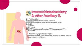  Positive stains
Beta catenin (98%): aberrant nuclear expression
Alpha-1-antichymotrypsin (95%), alpha-1-antitrypsin (82%)
Cyclin D1
CD10 (63%)
SOX11 (100%)
CD56 (96%), neuron specific enolase (70%), synaptophysin (55%)
CD99 (dot-like)
 Molecular / cytogenetics description
- Point mutation in exon 3 of β catenin gene (CTNNB1) is present in > 90% .
- Rarely, mutations in APC gene .
 