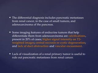 Comprehensive Overview of Pancreatic Neoplasms: Diagnosis and Imaging ...