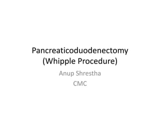 Pancreaticoduodenectomy
(Whipple Procedure)
Anup Shrestha
CMC
 