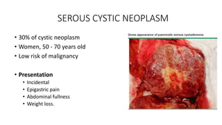 SEROUS CYSTIC NEOPLASM
• 30% of cystic neoplasm
• Women, 50 - 70 years old
• Low risk of malignancy
• Presentation
• Incidental
• Epigastric pain
• Abdominal fullness
• Weight loss.
 