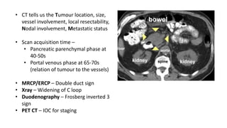 • CT tells us the Tumour location, size,
vessel involvement, local resectability,
Nodal involvement, Metastatic status
• Scan acquisition time –
• Pancreatic parenchymal phase at
40-50s
• Portal venous phase at 65-70s
(relation of tumour to the vessels)
• MRCP/ERCP – Double duct sign
• Xray – Widening of C loop
• Duodenography – Frosberg inverted 3
sign
• PET CT – IOC for staging
 