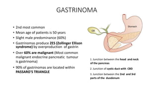 GASTRINOMA
• 2nd most common
• Mean age of patients is 50 years
• Slight male predominance (60%)
• Gastrinomas produce ZES (Zollinger Ellison
syndrome) by overproduction of gastrin
• Over 60% are malignant (Most common
malignant endocrine pancreatic tumour
is gastrinoma)
• 90% of gastrinomas are located within
PASSARO'S TRIANGLE
1. Junction between the head and neck
of the pancreas
2. Junction of cystic duct with CBD
3. Junction between the 2nd and 3rd
parts of the duodenum
 