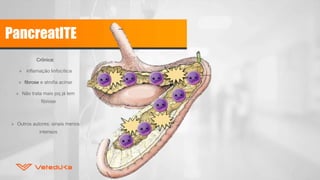 PancreatITE
Crônica:
» inflamação linfocítica
» fibrose e atrofia acinar
» Não trata mais pq já tem
fibrose
» Outros autores: sinais menos
intensos
 